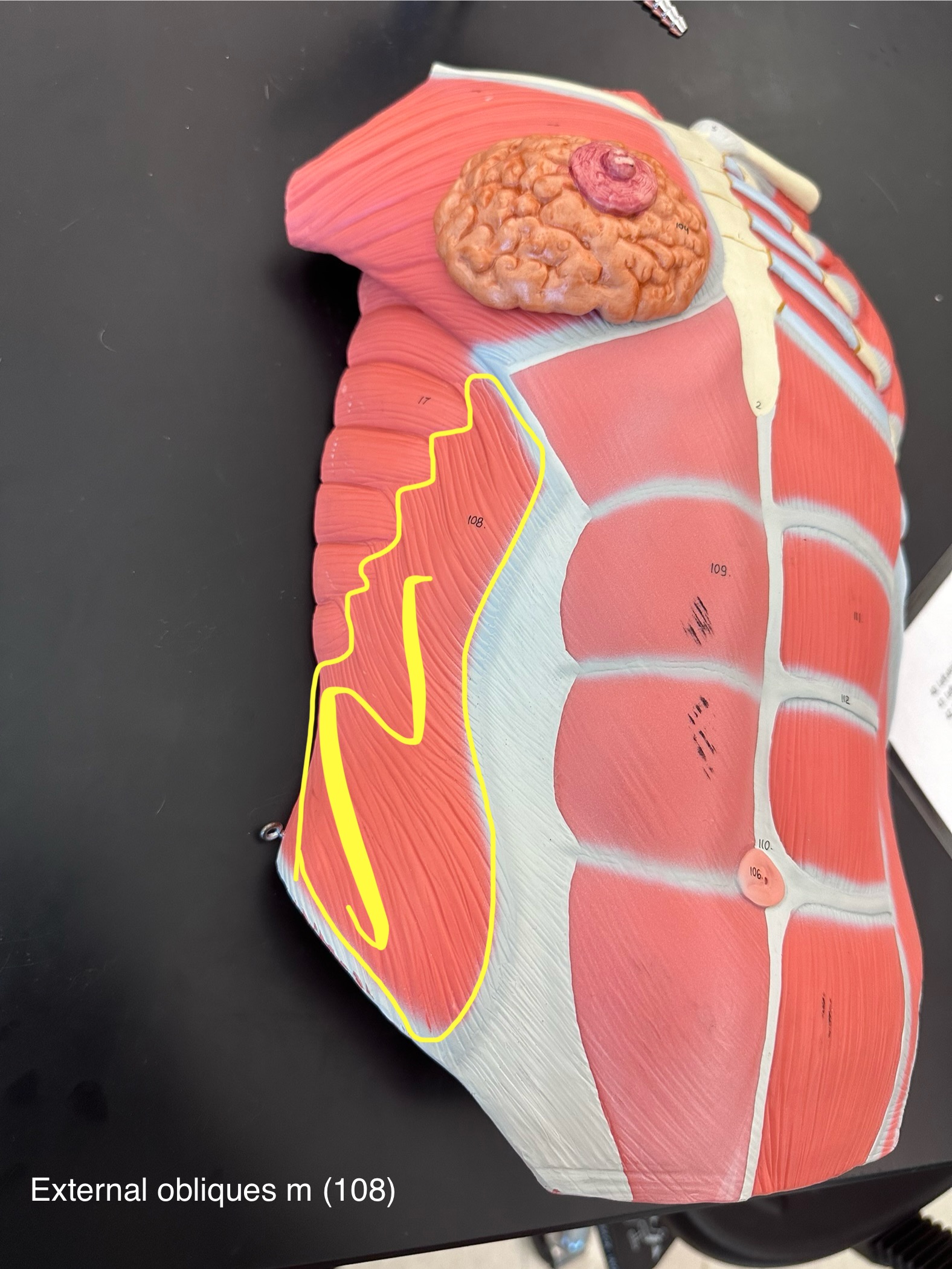 <p>External obliques muscle</p>
