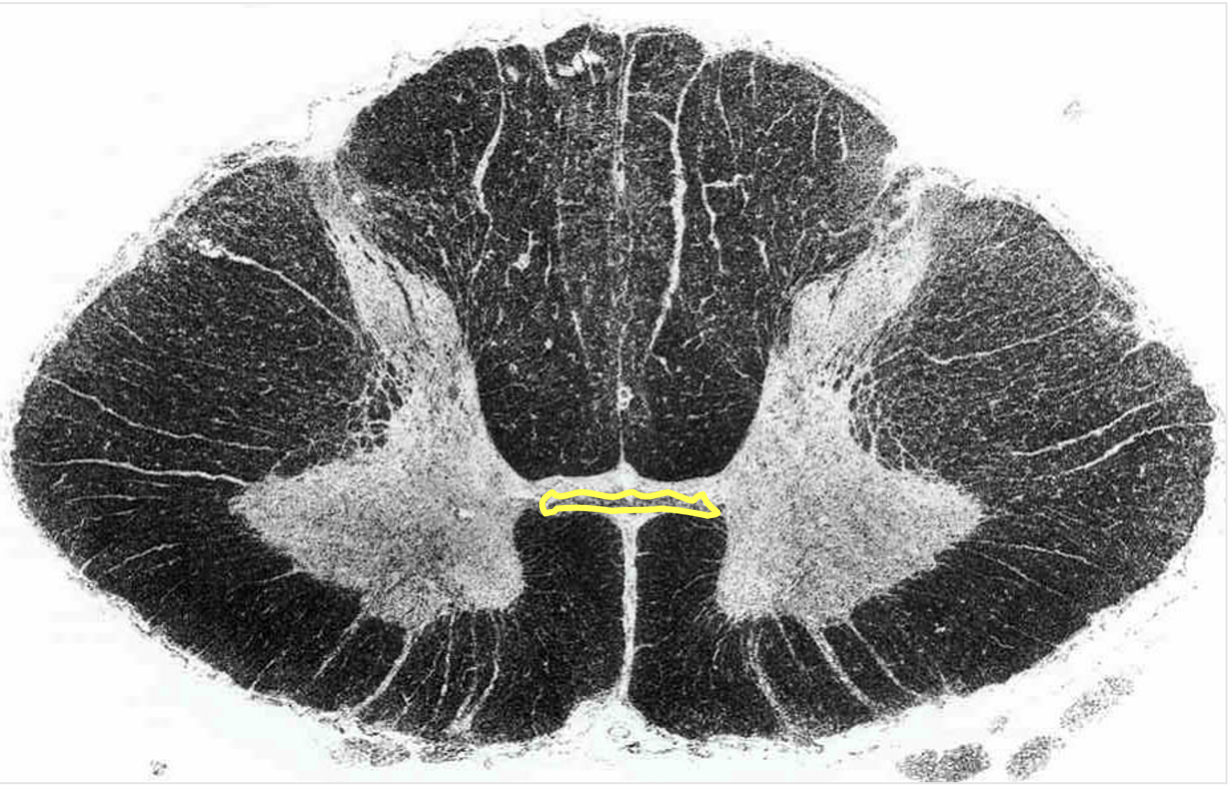 <p>located dorsal to the anterior median fissure </p><ul><li><p>contains axons from one side of spinal cord to another </p></li></ul><p></p>