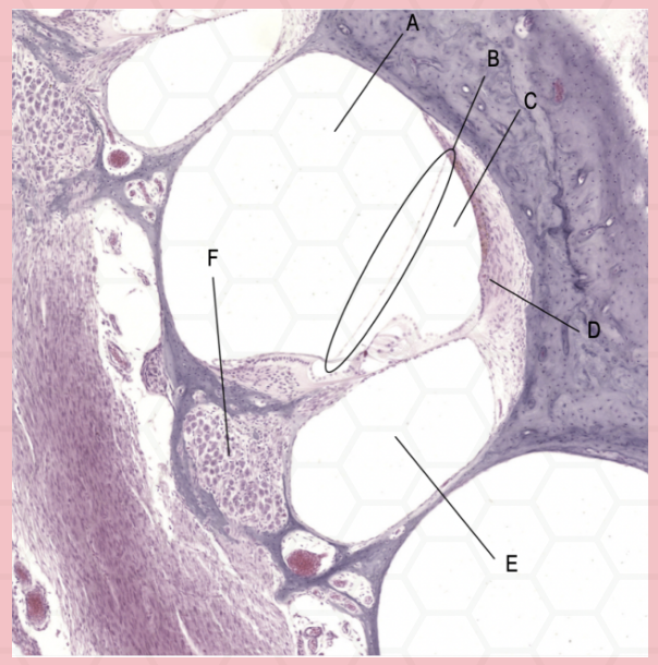 <p>Identify the structure labeled as A.</p>
