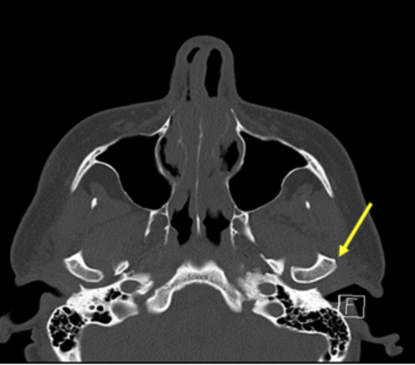 <p>identify the structure </p>