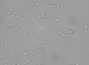 <p>Which sp is this? At what temperature?</p>