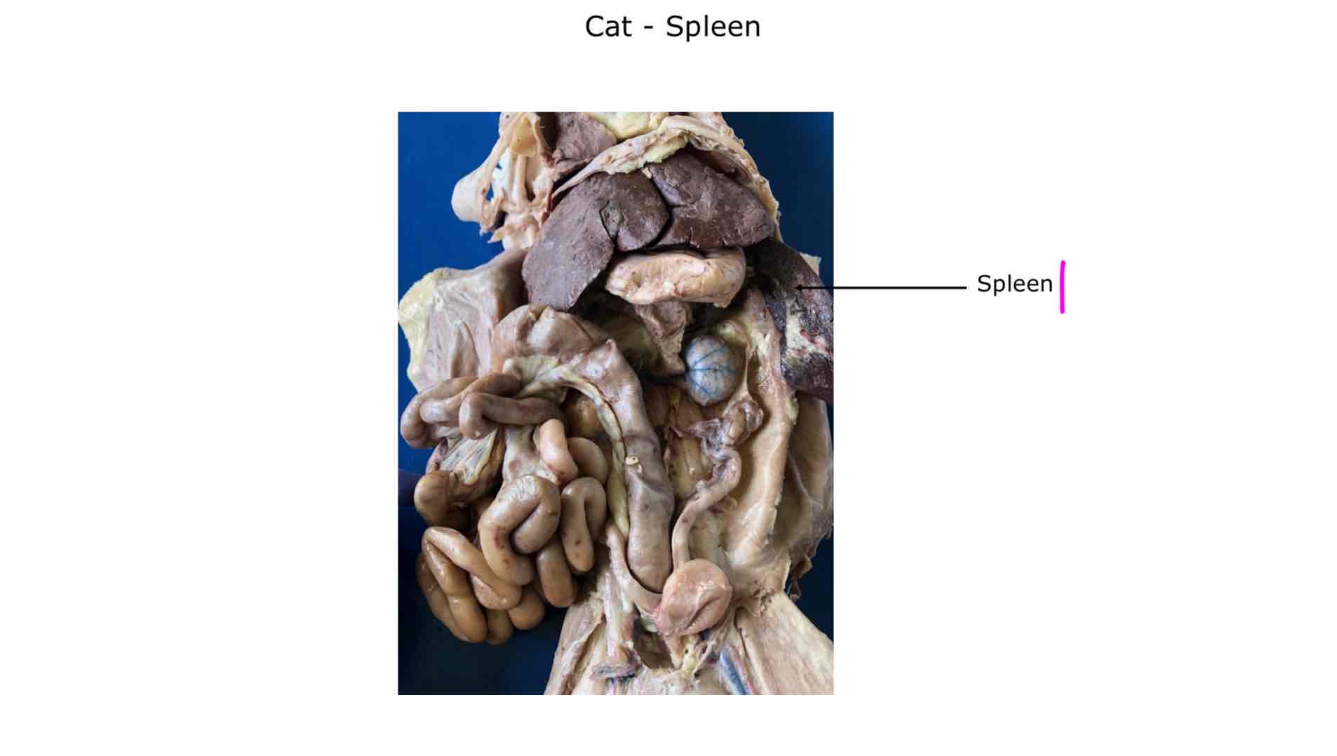 <p>Spleen</p>