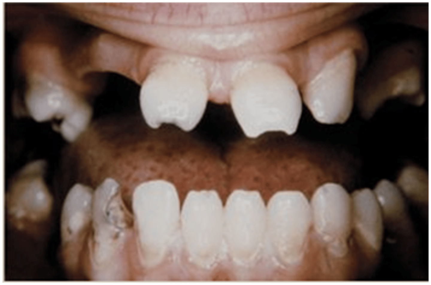 <p>What could this be from?</p>