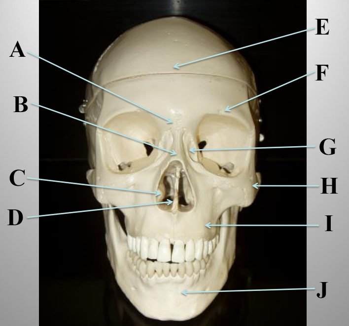 <p>What structure is letter C?</p>