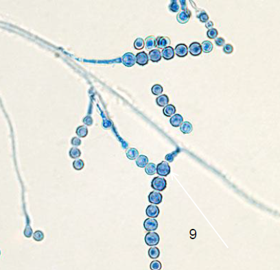 <p>Based on the colony and microscopic morphology pictured below, what is the genus identification of the organism isolated?</p>