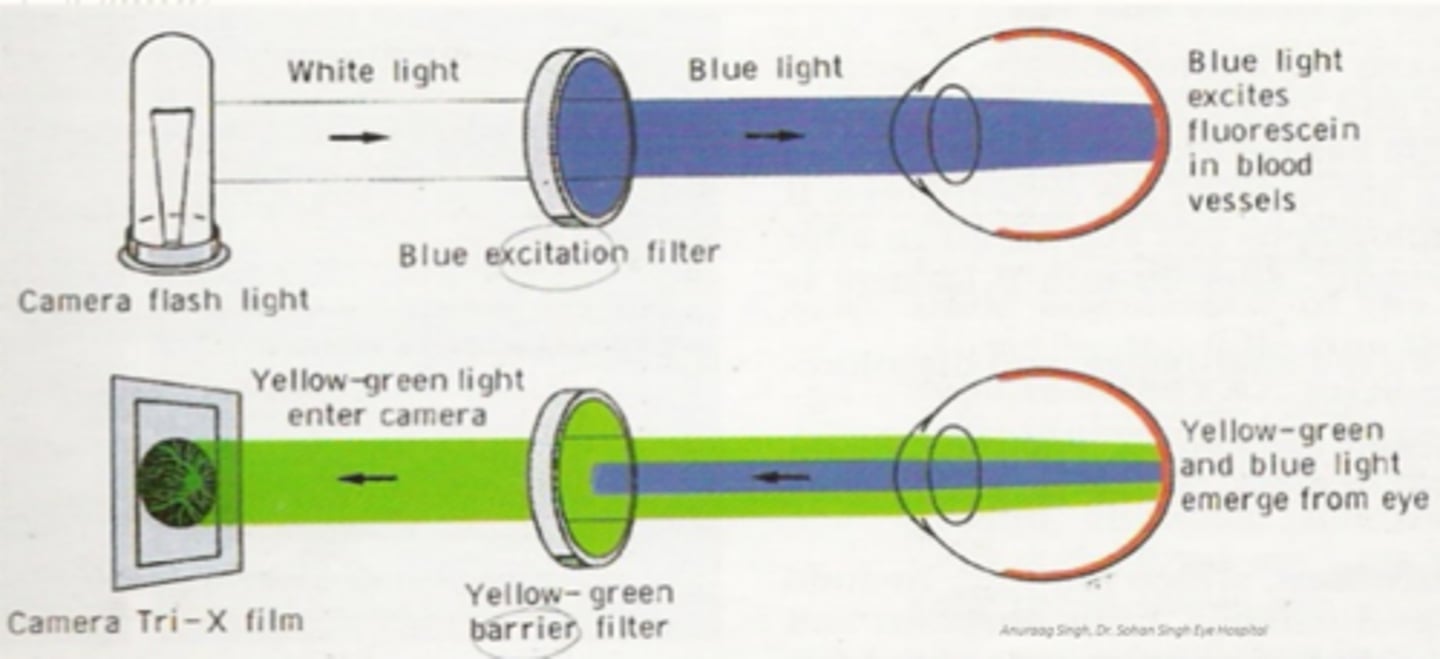 <p>white light from flash passes through blue filter = blue light hits retina = fluorescein in blood is excited = yellow-green and blue light leaves eye = yellow-green filter allows only Y-G light through to camera, no B light</p>