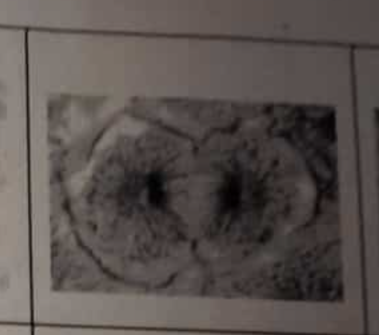 <p>Two daughter nuclei are formed</p>