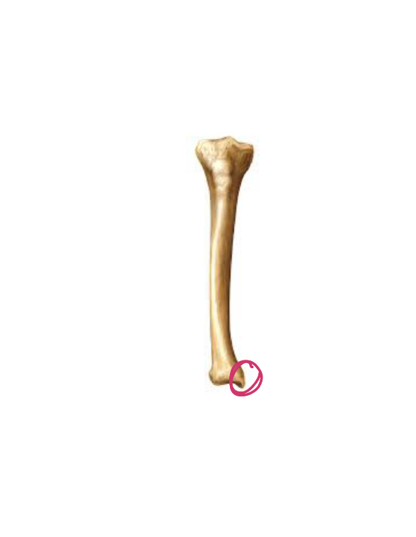 <p>Bump on tibia , inside </p>
