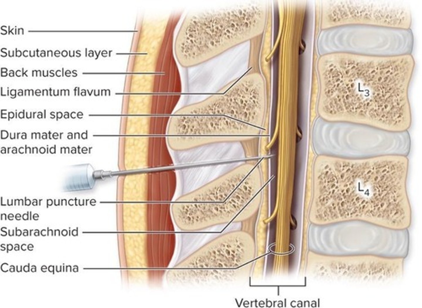 <p>A large fold of dura mater separating the left and right hemispheres of the brain</p>