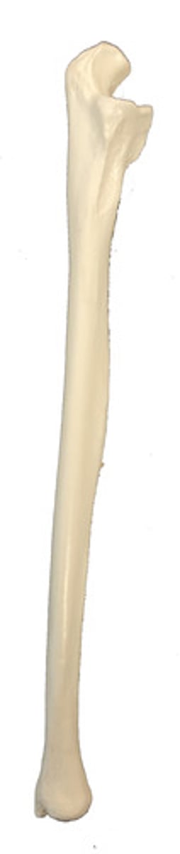 <p>Identify this bone.</p>