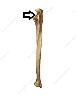 <p>what part of the ulna is this?</p>