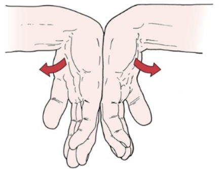 <p><span style="color: #NaNNaNNaN"><strong>•Tests for:</strong> Carpal tunnel syndrome</span><span style="color: #NaNNaNNaN"><br></span><span style="color: #NaNNaNNaN"><strong>•Positive sign:</strong></span><span style="color: #NaNNaNNaN"><br></span><span style="color: #NaNNaNNaN">• Tingling sensation in the</span><span style="color: #NaNNaNNaN"><br></span><span style="color: #NaNNaNNaN">thumb index finger and</span><span style="color: #NaNNaNNaN"><br></span><span style="color: #NaNNaNNaN">middle and lateral half</span><span style="color: #NaNNaNNaN"><br></span><span style="color: #NaNNaNNaN">of ring finger (median</span><span style="color: #NaNNaNNaN"><br></span><span style="color: #NaNNaNNaN">nerve distribution)</span><span style="color: #NaNNaNNaN"><br></span><span style="color: #NaNNaNNaN"><strong>•Method:</strong></span><span style="color: #NaNNaNNaN"><br></span><span style="color: #NaNNaNNaN">• Examiner flexes patients</span><span style="color: #NaNNaNNaN"><br></span><span style="color: #NaNNaNNaN">wrists maximally and</span><br><span style="color: #NaNNaNNaN">holds this position for 1 min pushing the wrists</span></p>