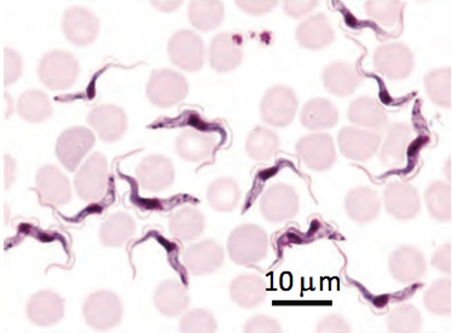 <p>African Trypanosomiasis (aka African Sleeping Sickness)​</p><p>Protozoa - Excavata</p><p>diagnosed from blood smear, parasitic</p><p>undulating, squiggly membrane</p>