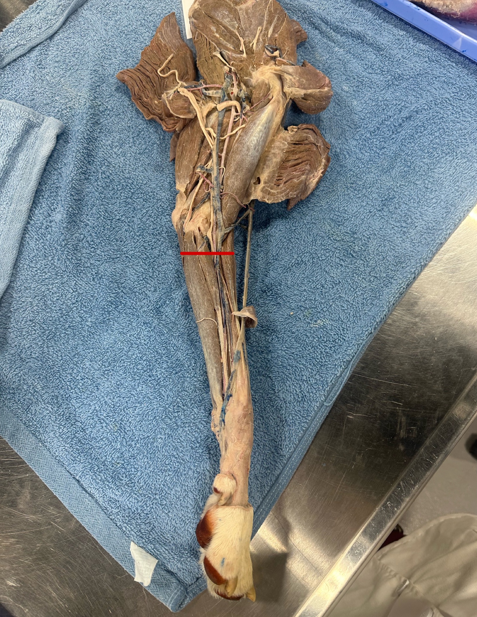 <p>When performing a dissection you accidentally cut the labeled vein</p><ul><li><p>what is this vein</p></li></ul><ul><li><p>What vein might we see bleed due to this cut</p></li></ul><p></p>