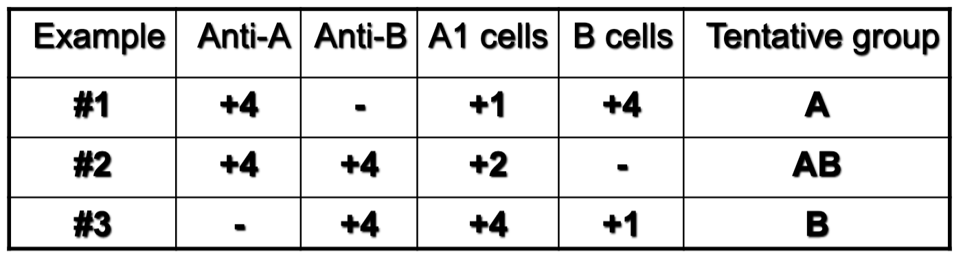<p>which example depicts anti-A1 in A2 or A2B patient?</p>