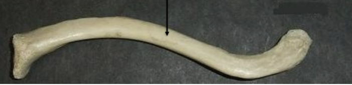 <p>Label this bone </p>