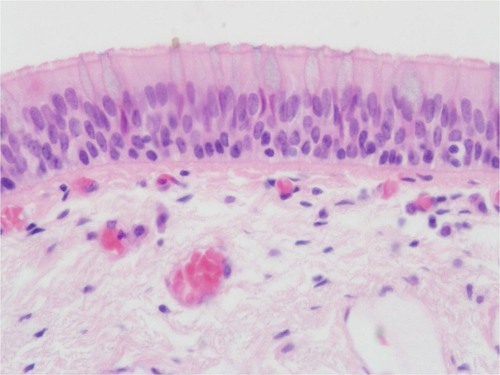 type of epithelial tissue, function, and location?