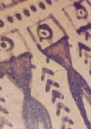 <p>prothesis</p>