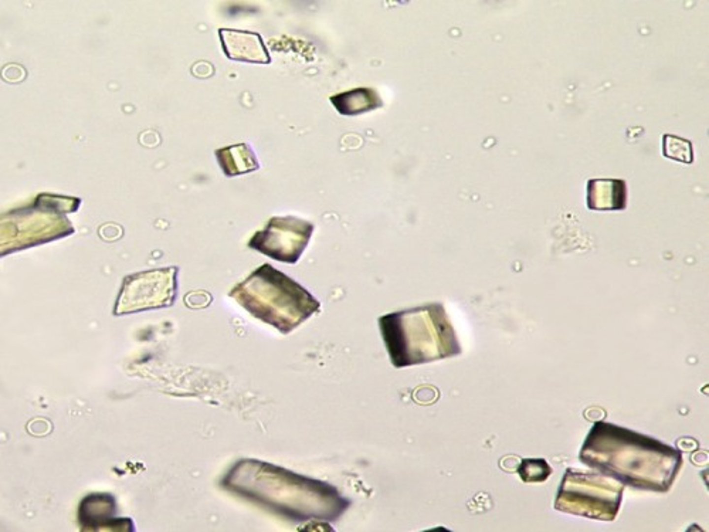 <p>-Normal=seen in variety of shapes, and highly birefringent under polarized light</p><p>-pH= acid</p><p>-color= yellow-brown (rosettes, wedges)</p>