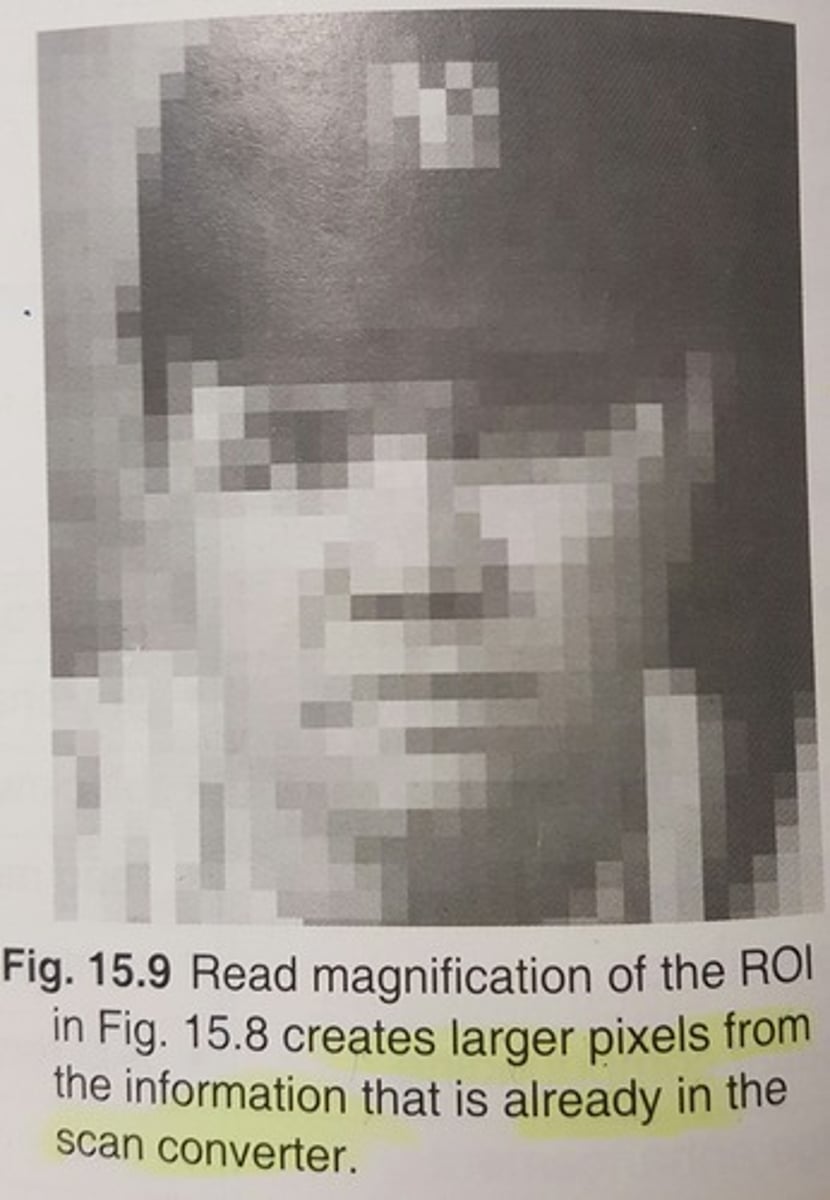 <p>uses old data, postprocessing, larger pixel size, same # of pixels as in the original ROI, unchanged spatial resolution, unchanged temporal resolution</p>