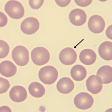 <p>What characteristic describes the size of this erythrocyte?</p>