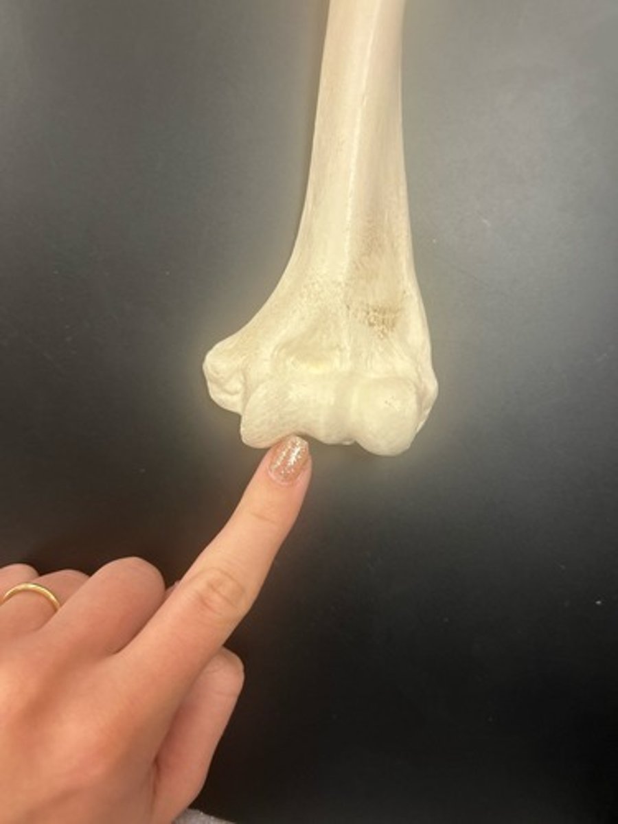 <p>name the bone</p>
