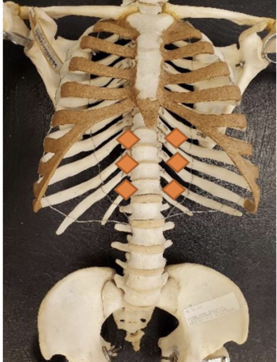 <p>1/2 distance between xiphoid and umbilicus; just lateral to midline bilaterally</p>
