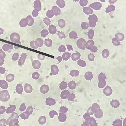 <p>Identify the cell pointed at</p>