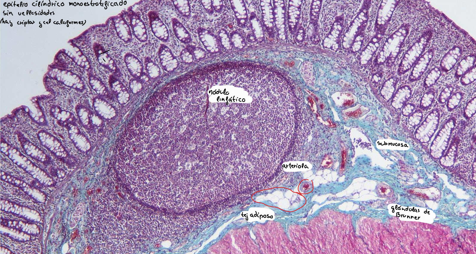 knowt flashcard image