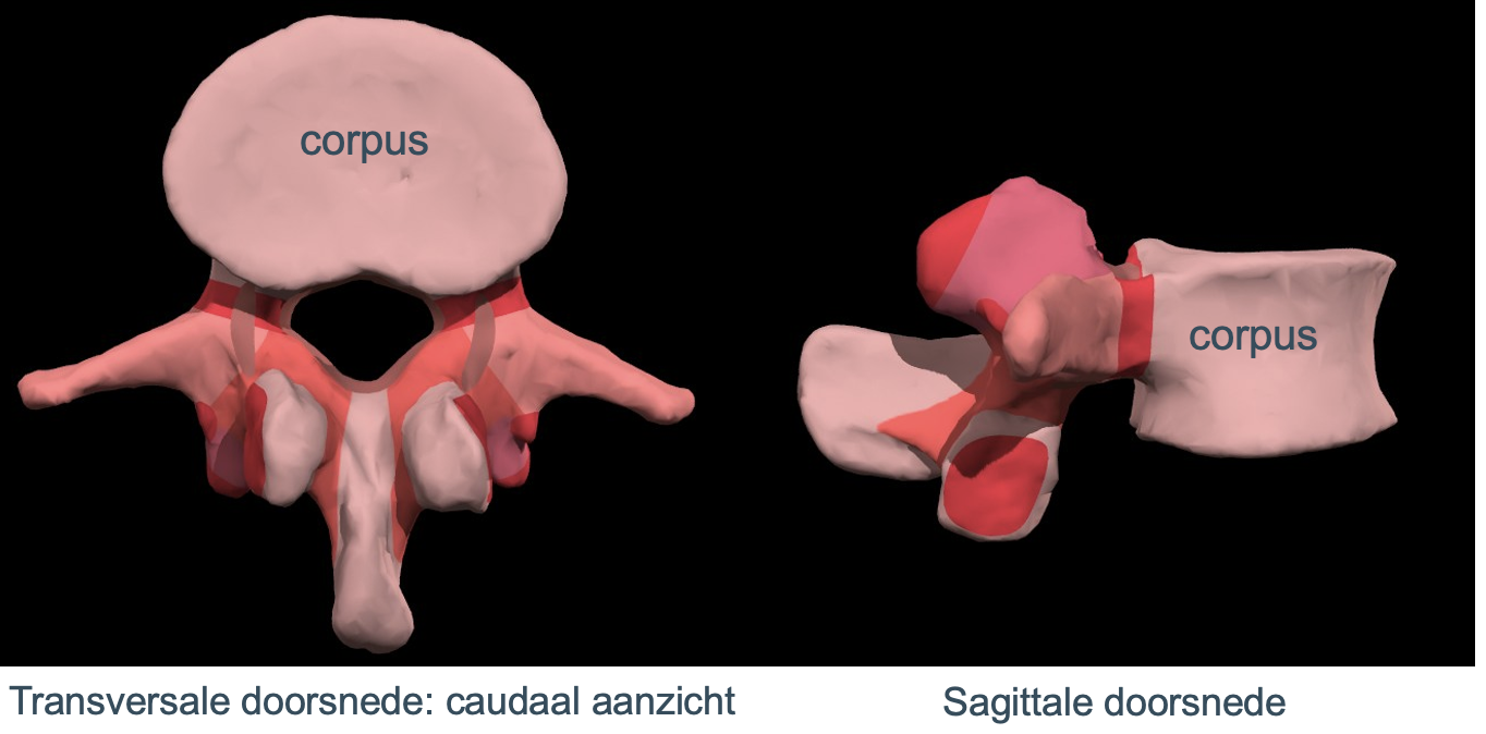<p>corpus vertebrae&nbsp;</p>