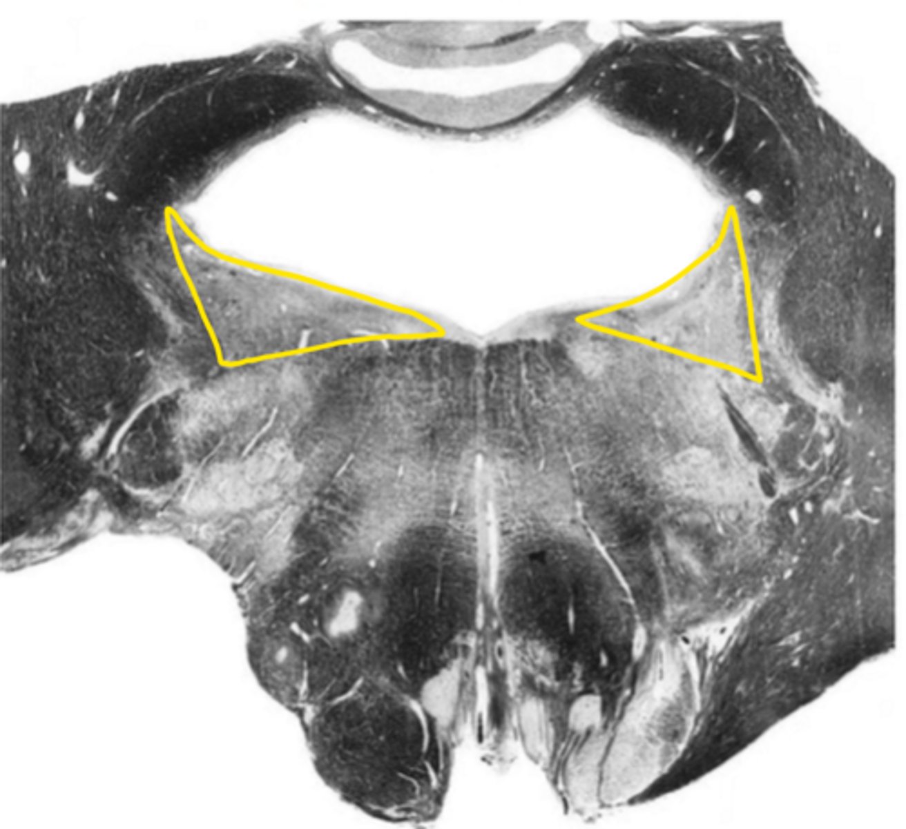 <p>ID the nucleus</p>