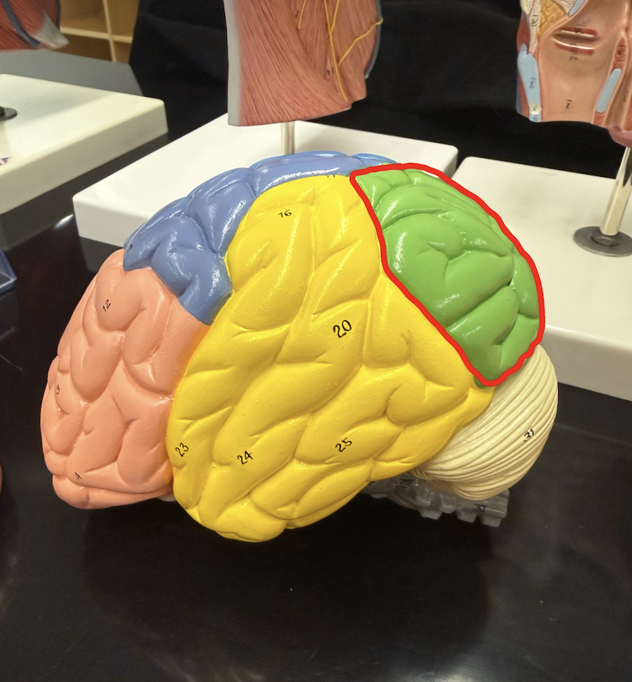 <p>What part of the brain is outlined in red?</p>