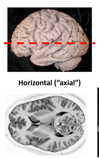 <p>Horizontal sectioning</p>