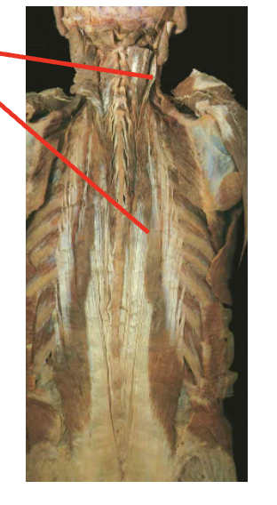 <p>what is this muscle.&nbsp;What is its origin. Where does it inserts. </p>