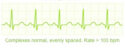 <p>What ECG trace is this?</p>