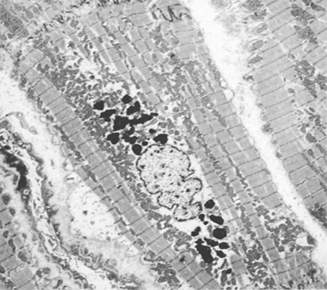 <p>PAS and Variably acid fast (in carbol fuscin)</p>