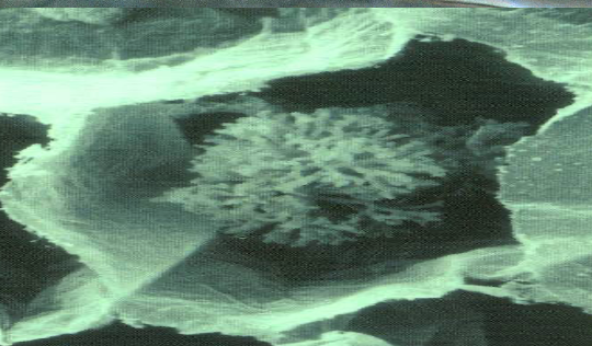 <p>is this endotrophic or ectotrophic</p>
