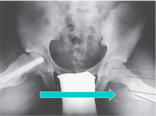 <p>What is the projection and anatomy shown in this image?</p>