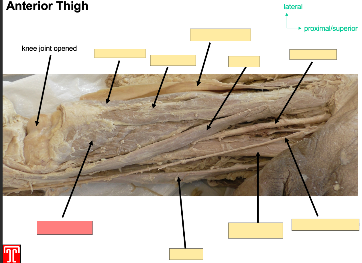 <p>Describe the quadriceps femoris</p>