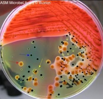 <p>Selective = G-, bile salts</p><p>Differential:</p><p>lactose fermentation, bromothymol blue &amp; acid fuchsin</p><p>— orange color change </p><p>Hydrogen sulfide gas production, sodium thiosulfate &amp; ferric citrate</p><p>— black color change </p>