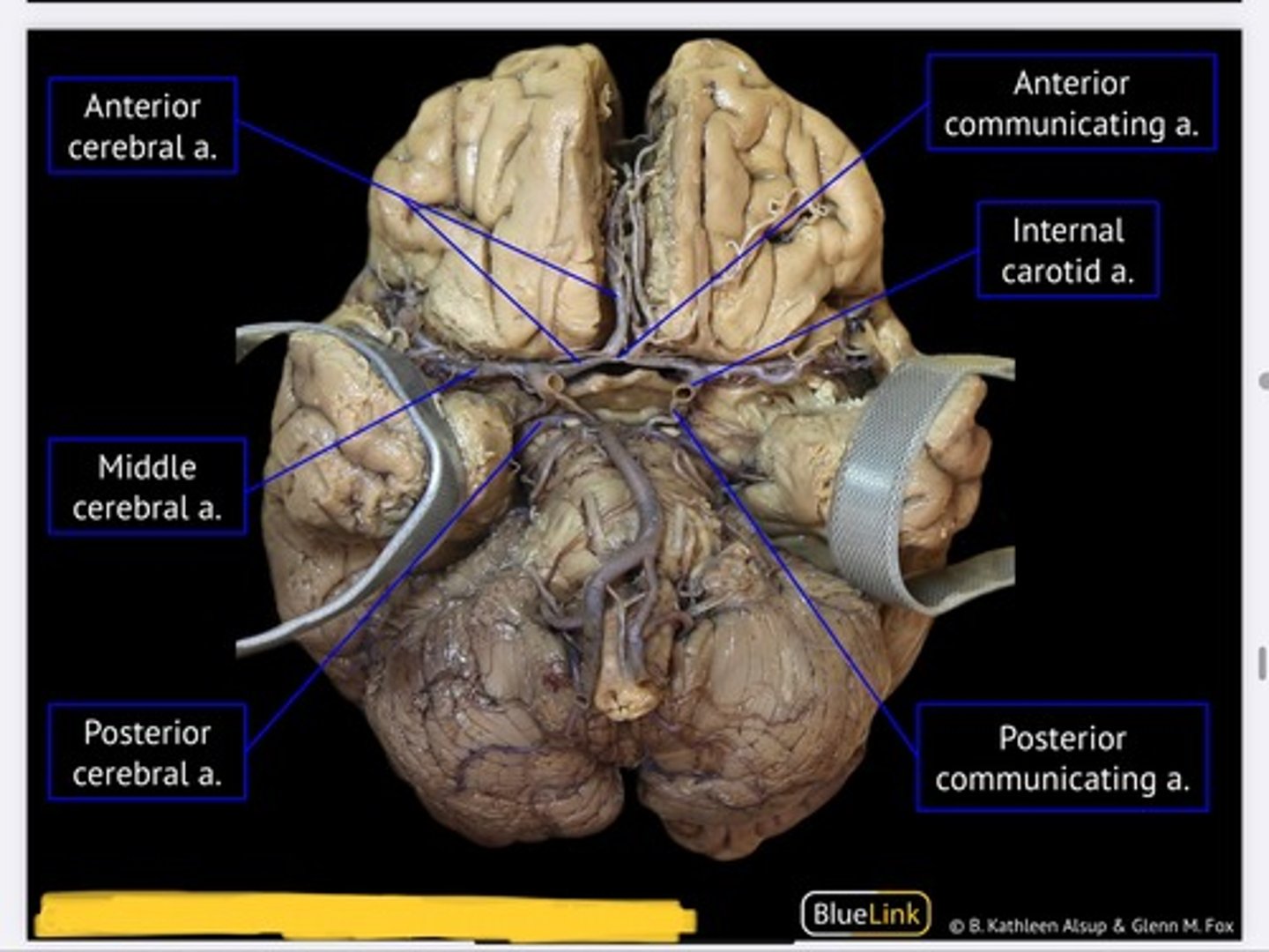 knowt flashcard image
