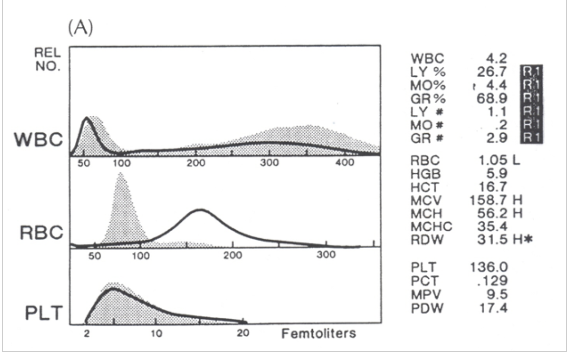 <p>which statements apply to this histogram?</p>