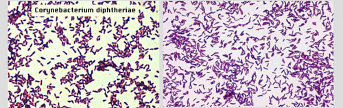 <p>Causes diptheria: a serious infection of the nose/throat in humans</p>