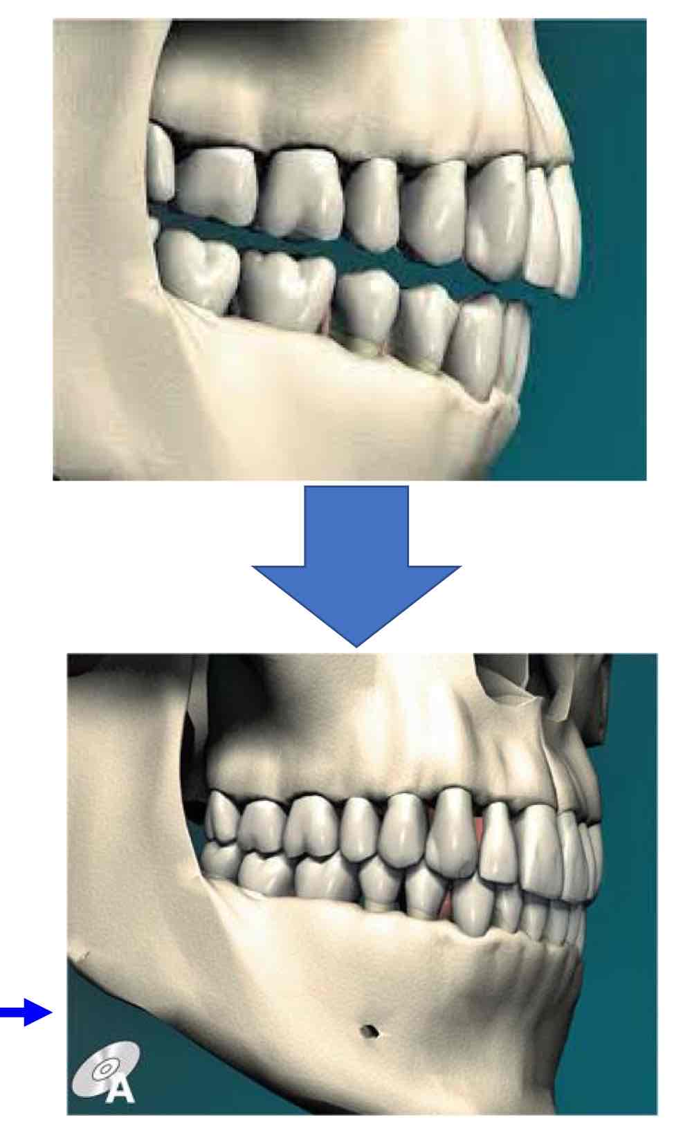 <p>when most of your teeth in contact  </p>