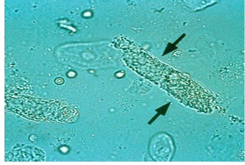 <p>what are granular casts?</p><p>What do non pathogenic granular casts contain?</p>
