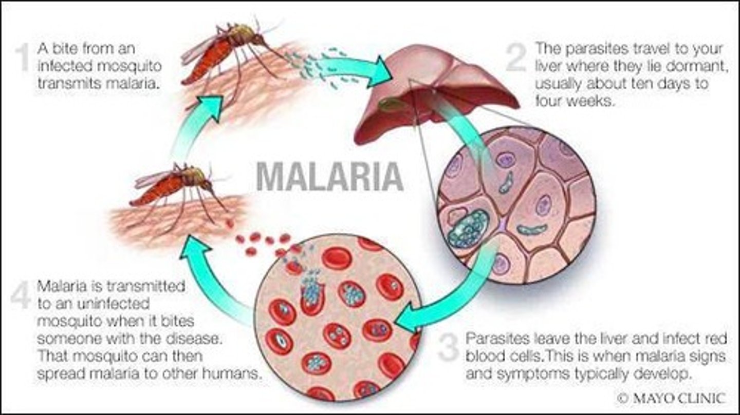 <p>A parasitic infection that is more common and severe in immunosuppressed individuals.</p>