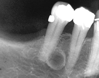 <p>What is this dental anomaly?</p>