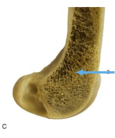 * also known as Spongy bone
* Primarily on the ends, within the epiphyses
* 3d lattice of thin bone, like spider webs
* Allows for some mobility within the epiphysis, to absorb shock
* Participates in producing blood cells – part of the circulatory system