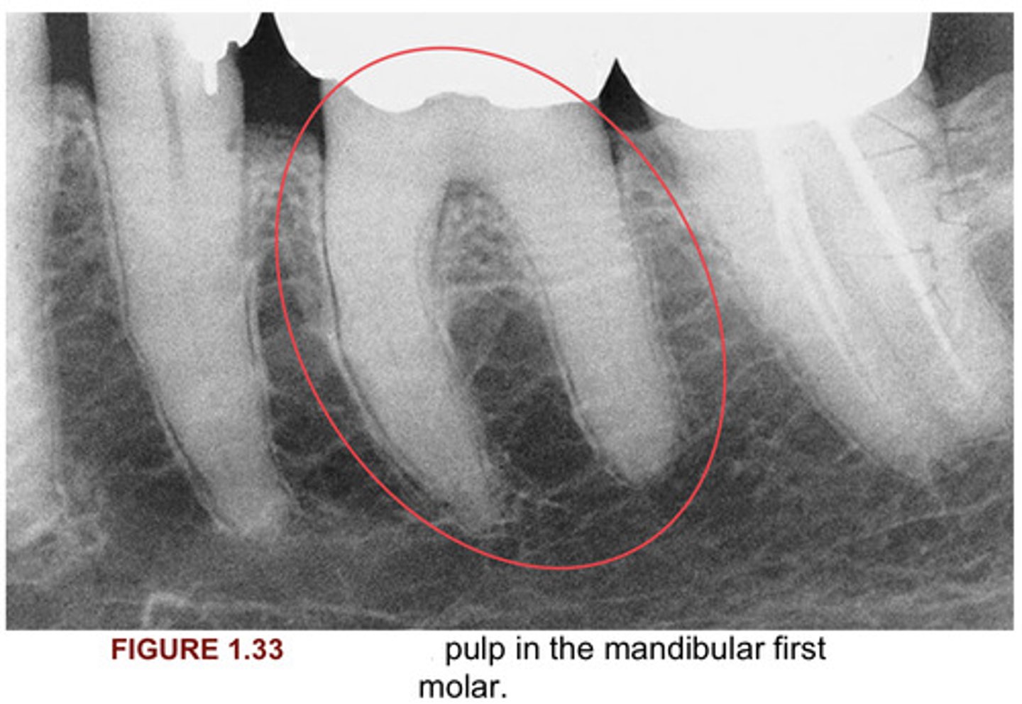 <p>In figure 1.33, please fill in the blank.</p>