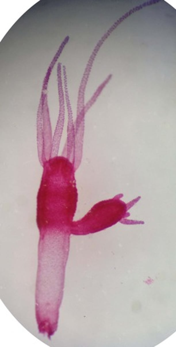 <p>when a new organism grows out of the parent's body</p>